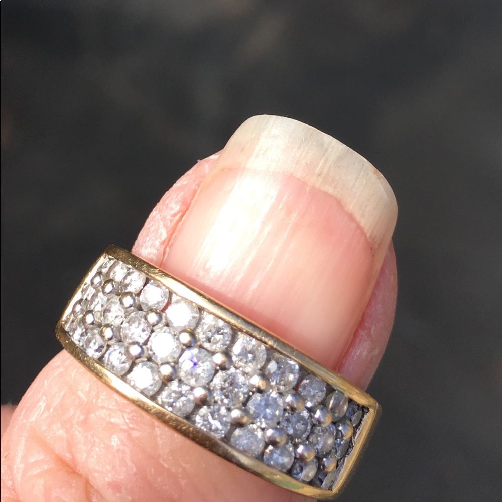 Ring - Picture 3 of 5